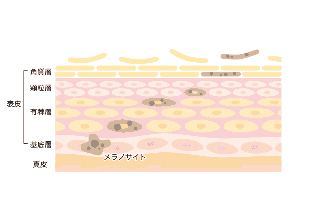 シミトリー